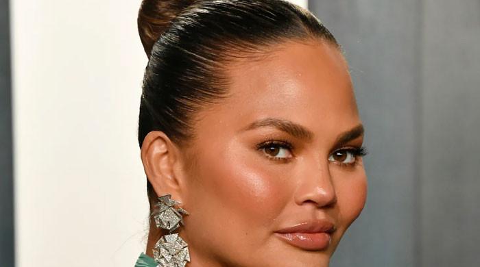 Chrissy Teigen’s surgery details come to light